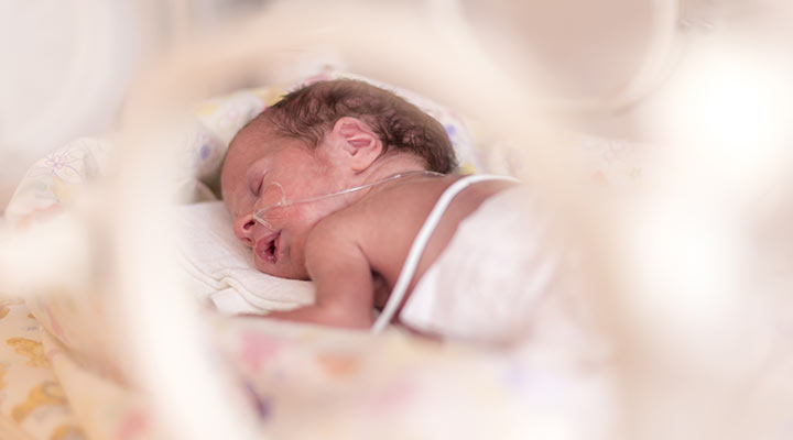 Neonatal Intensive Care Baby